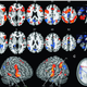 Imagen: Plos One